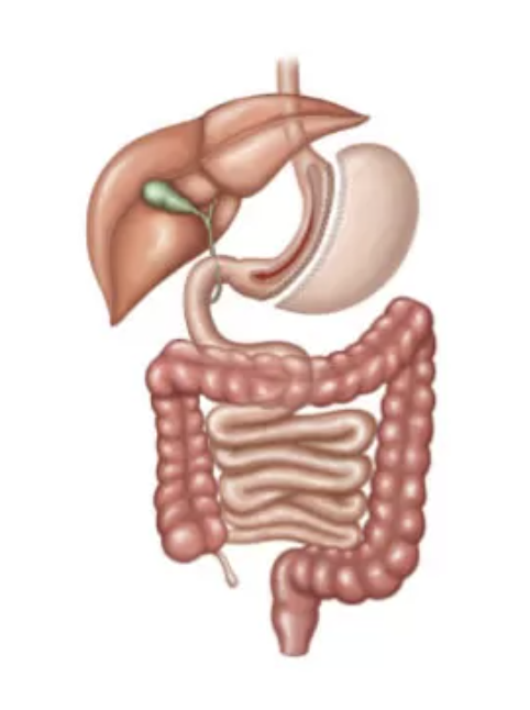 Sleeve Gástrico em Curitiba - Dr. Gustavo Castro