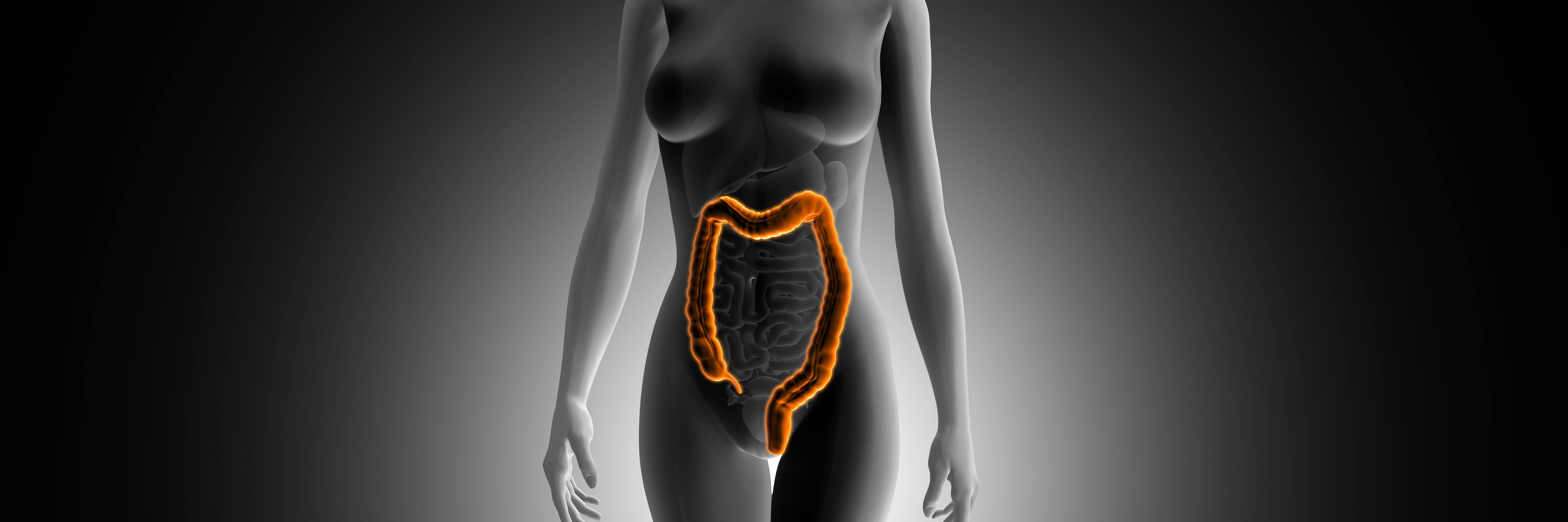 Cirurgia de Endometriose - Dr. Gustavo Castro