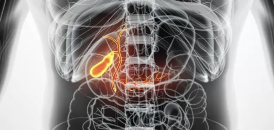 Como identificar pedra na vesícula biliar Dr. Gustavo Castro em Curitiba
